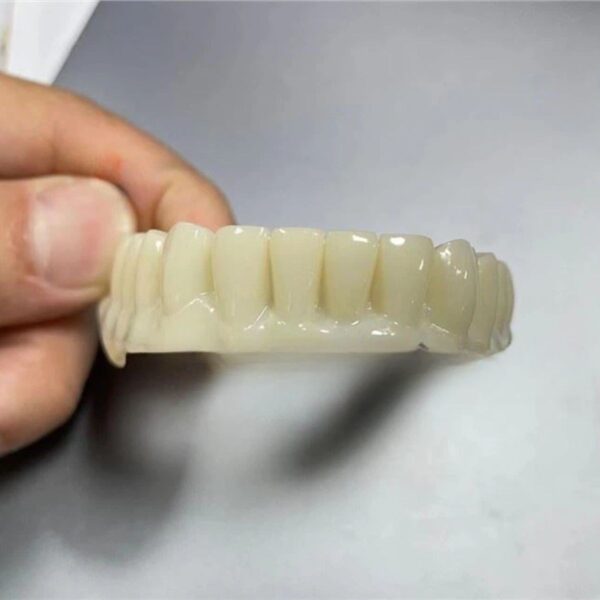 Professional temporary crown design PMMA for immediate implant loading showing CAD/CAM workflow and clinical placement