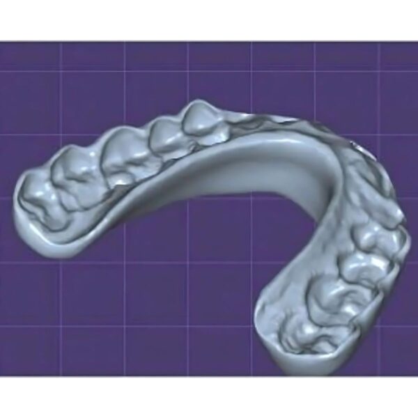 Dental splint design CAD/CAM STL file showing occlusal contacts and retention features ready for 3D printing