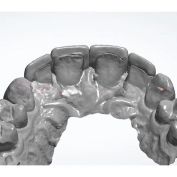 Professional dental veneer design CAD file showing optimal aesthetic contours and natural translucency
