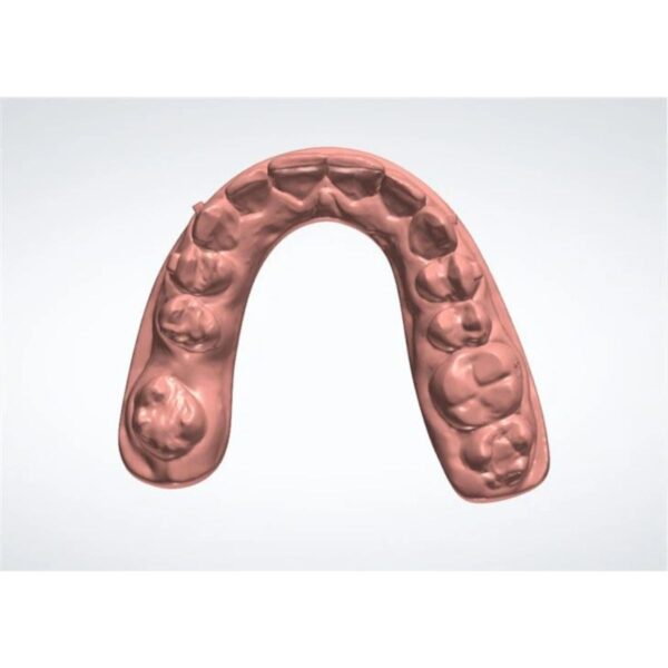 Professional clear aligners design CAD service - sequential orthodontic treatment planning for dental labs