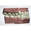 Complete clear aligners design and finish service - CAD treatment planning to production ready files