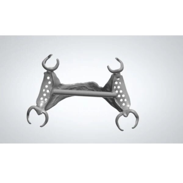 Professional dental partial design CAD workflow showing RPD framework modeling for removable partial dentures