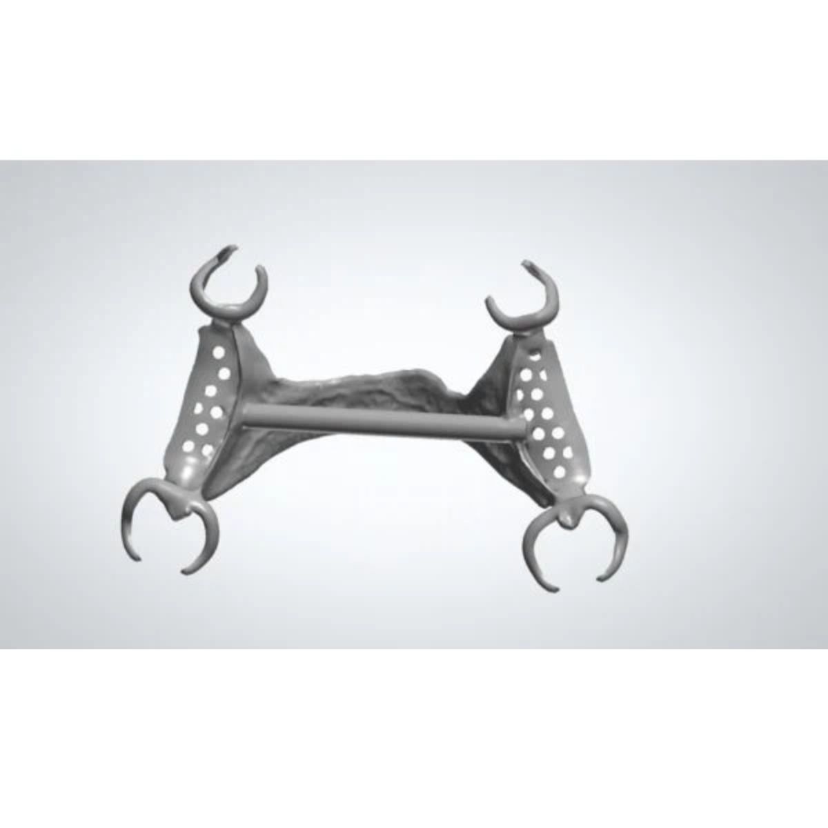 dental-partial-design-rpd-cad-professional-service Professional dental partial design CAD workflow showing RPD framework modeling for removable partial dentures