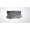 Professional full denture design CAD workflow showing digital modeling process for complete denture fabrication