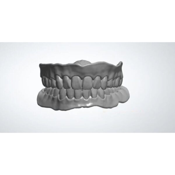 Professional full denture design CAD workflow showing digital modeling process for complete denture fabrication